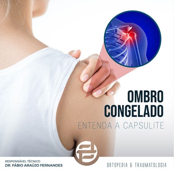 ombro-congelado-entenda-a-capsulite-blog-dr-fabio-araujo-ortopedia-traumatologia-parana