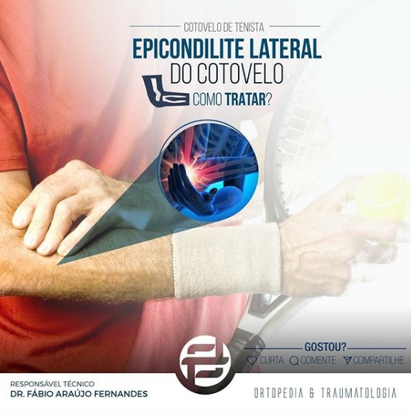 cotovelo-de-tenista-como-tratar-epicondilite-lateral-do-cotovelo-blog-dr-fabio-araujo-ortopedia-traumatologia-parana